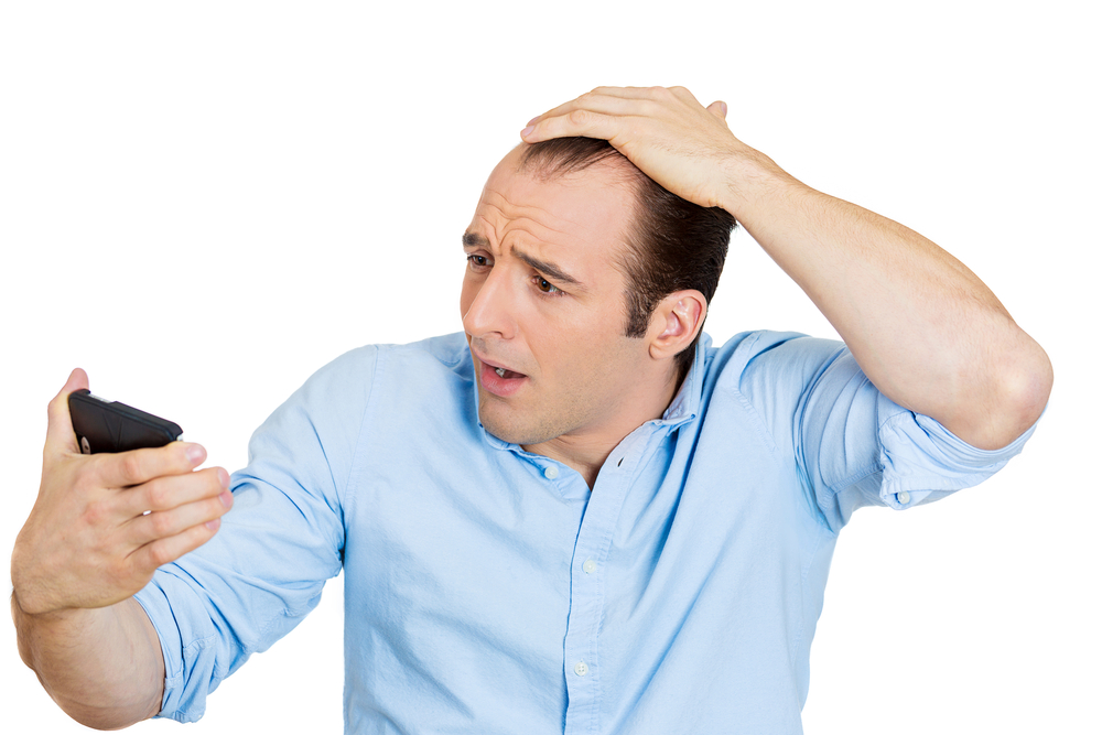 male hair loss.jpg